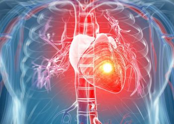 Definition and Risk Factor for Acute Myocardial Infarction
