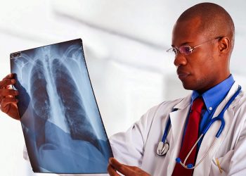 Knowing Lung Cancer Treatment and Symptoms