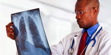 Knowing Lung Cancer Treatment and Symptoms