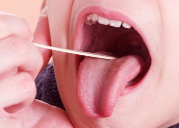 Tongue Cancer: Causes, Symptoms and How to Prevent it