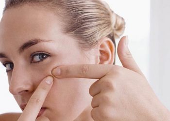 How to Get Rid of Blackheads in Effective Ways