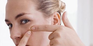 How to Get Rid of Blackheads in Effective Ways