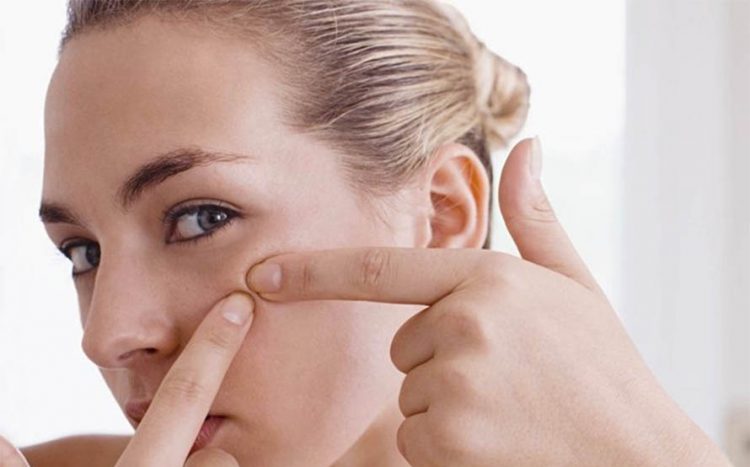 How to Get Rid of Blackheads in Effective Ways